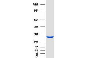 Validation with Western Blot