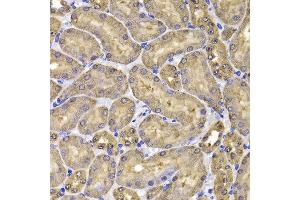 Immunohistochemistry of paraffin-embedded mouse kidney using FKBP6 antibody at dilution of 1:100 (x400 lens). (FKBP6 anticorps)