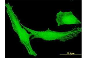 Immunofluorescence of purified MaxPab antibody to LRRC23 on HeLa cell.