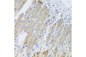 Immunohistochemistry of paraffin-embedded mouse stomach using RARS2 antibody (ABIN5974692) at dilution of 1/100 (40x lens). (RARS2 anticorps)