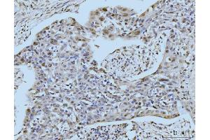 IHC analysis of SBNO1 using anti-SBNO1 antibody (ABIN7601710). (SBNO1 anticorps  (AA 43-1303))
