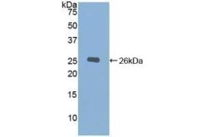 Detection of Recombinant CHRD, Mouse using Polyclonal Antibody to Chordin (CHRD) (Chordin anticorps  (AA 422-635))