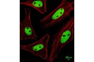 Immunofluorescent analysis of Hela cells, using KRBA2 Antibody (Center) (ABIN655380 and ABIN2844933). (KRBA2 anticorps  (AA 157-186))