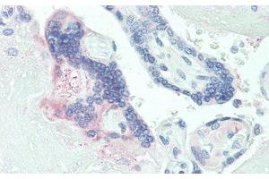 Detection of PLGF in Human Placenta Tissue using Polyclonal Antibody to Placenta Growth Factor (PLGF)
