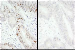 Immunohistochemistry (IHC) image for anti-Minichromosome Maintenance Complex Component 2 (MCM2) (pSer40), (pSer41) antibody (ABIN7449413)