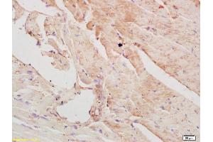 Formalin-fixed and paraffin embedded mouse heart labeled with Rabbit Anti PAPK/ALS2CR2 Polyclonal Antibody, Unconjugated (ABIN751273) at 1:200 followed by conjugation to the secondary antibody and DAB staining