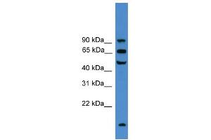 WB Suggested Anti-UMOD Antibody Titration:  0. (Uromodulin anticorps  (C-Term))