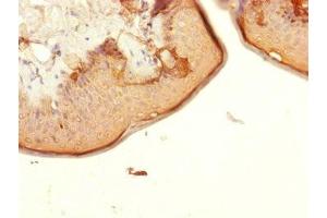 Immunohistochemistry of paraffin-embedded human skin tissue using ABIN7147366 at dilution of 1:100