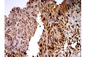 Immunohistochemistry (IHC) image for anti-Transcription Termination Factor, RNA Polymerase I (TTF1) (AA 1-150) antibody (ABIN5871603) (TTF1 anticorps  (AA 1-150))