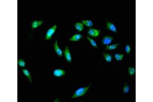 Immunofluorescent analysis of Hela cells using ABIN7150251 at dilution of 1:100 and Alexa Fluor 488-congugated AffiniPure Goat Anti-Rabbit IgG(H+L) (POLI anticorps  (AA 458-711))