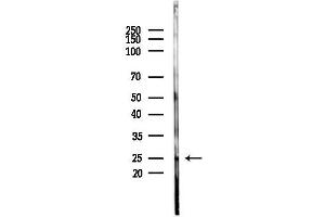 anti-Eukaryotic Translation Initiation Factor 4E (EIF4E) (pSer209) antibody