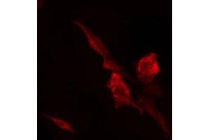 ABIN6274784 staining 293 cells by IF/ICC. (RPL7 anticorps  (C-Term))