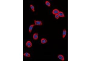 Immunofluorescent analysis of VEGFR2 (pY1214) staining in MCF cells. (VEGFR2/CD309 anticorps  (C-Term, pTyr1214))