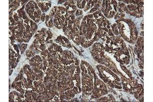Image no. 2 for anti-RAB30, Member RAS Oncogene Family (RAB30) antibody (ABIN1500558)
