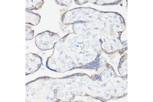 Immunohistochemistry of paraffin-embedded human placenta using CLUH antibody  at dilution of 1:100 (40x lens). (CLUH anticorps  (AA 1120-1309))