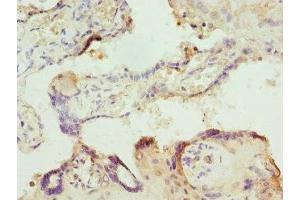 Immunohistochemistry of paraffin-embedded human placenta tissue using ABIN7156320 at dilution of 1:100 (ITPK1 anticorps  (AA 185-414))