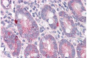 Human Small Intestine (formalin-fixed, paraffin-embedded) stained with SLC9A1 antibody ABIN343902 at 5 ug/ml followed by biotinylated goat anti-rabbit IgG secondary antibody ABIN481713, alkaline phosphatase-streptavidin and chromogen. (SLC9A1 anticorps  (C-Term))