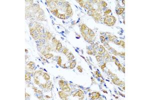 Immunohistochemistry of paraffin-embedded human stomach using DARS2 antibody (ABIN5975194) at dilution of 1/100 (40x lens). (DARS2 anticorps)