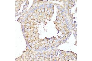 Immunohistochemistry of paraffin-embedded mouse testis using MME antibody. (MME anticorps  (AA 52-352))