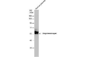 WB Image Human tissue extract (30 μg) was separated by 10% SDS-PAGE, and the membrane was blotted with Angiotensinogen antibody [N1C3] , diluted at 1:500. (AGT anticorps)