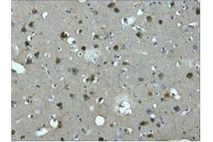 IHC staining of Human brain tissue paraffin-embedded, diluted at 1:200. (MAP2 anticorps)