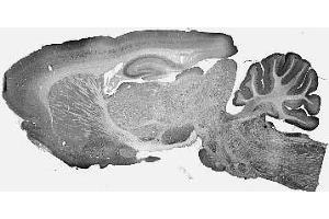 Adult rat brain immunohistochemistry. (IB2 anticorps  (AA 226-421))