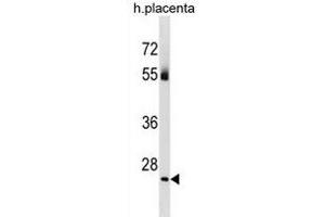 TBC1D26 Antibody (C-term) (ABIN1881871 and ABIN2838991) western blot analysis in human placenta tissue lysates (35 μg/lane). (TBC1D26 anticorps  (C-Term))