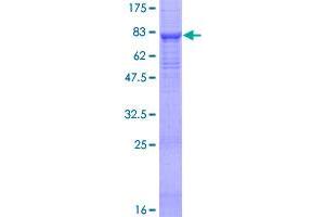 Image no. 1 for Sperm Adhesion Molecule 1 (PH-20 Hyaluronidase, Zona Pellucida Binding) (SPAM1) (AA 1-509) protein (GST tag) (ABIN1321071)