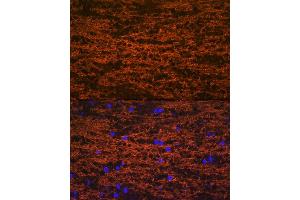 Immunofluorescence analysis of mouse brain using Myelin oligodendrocyte glycoprotein Rabbit mAb (ABIN7268722) at dilution of 1:100 (40x lens).