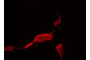 ABIN6274388 staining HeLa by IF/ICC.