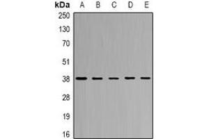 Western blot analysis of CapG expression in SW620 (A), THP1 (B), mouse lung (C), mouse spleen (D), rat heart (E) whole cell lysates. (CAPG anticorps)