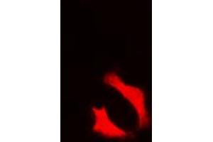 Immunofluorescent analysis of NFAT3 (pS676) staining in MCF7 cells.