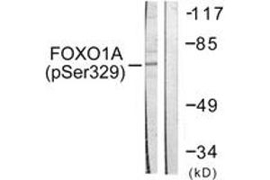 Western blot analysis of extracts from HeLa cells treated with Serum 20% 15', using FOXO1A (Phospho-Ser329) Antibody. (FOXO1 anticorps  (pSer329))