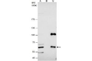IP Image CBS antibody immunoprecipitates CBS protein in IP experiments.