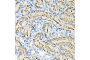 Immunohistochemistry of paraffin-embedded rat kidney using Glycerol kinase (GK) Rabbit mAb (ABIN7267457) at dilution of 1:100 (40x lens).