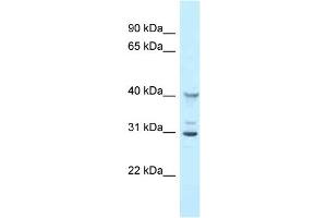 WB Suggested Anti-Oas1g Antibody Titration: 1. (OAS1G anticorps  (N-Term))