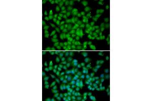 Immunofluorescence analysis of HeLa cells using CDKN2C antibody. (CDKN2C anticorps)