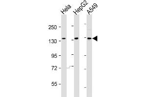 Western Blot at 1:2000 dilution Lane 1: Hela whole cell lysates Lane 2: HepG2 whole cell lysates Lane 3: A549 whole cell lysates Lysates/proteins at 20 ug per lane. (AATK anticorps  (N-Term))