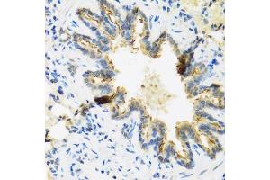 Immunohistochemistry of paraffin-embedded rat lung using DEFB4A antibody (ABIN3015538, ABIN3015539, ABIN3015540 and ABIN6218726) at dilution of 1:100 (40x lens). (DEFB4A anticorps  (AA 1-64))