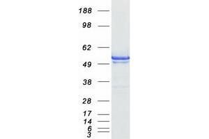 Validation with Western Blot