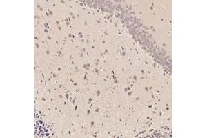 Immunohistochemistry analysis of paraffin-embedded rat striatum using,RMND5A (ABIN7075401) at dilution of 1: 3000 (RMND5A anticorps)