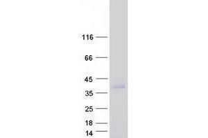Validation with Western Blot (FAM26F Protein (Myc-DYKDDDDK Tag))