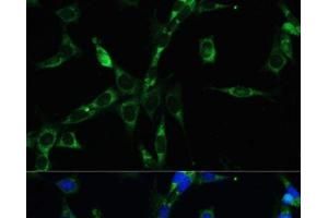 Immunofluorescence analysis of NIH-3T3 cells using BUB1B Polyclonal Antibody at dilution of 1:100. (BUB1B anticorps)