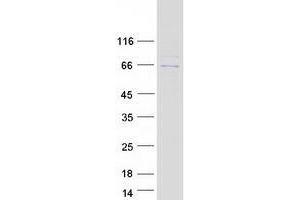 Validation with Western Blot