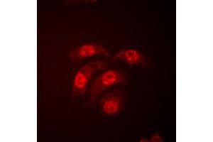Immunofluorescent analysis of p38 staining in HeLa cells. (MAPK14 anticorps  (Center))