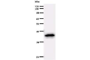 Western Blotting (WB) image for anti-Sex Comb On Midleg-Like 2 (SCML2) antibody (ABIN933093) (SCML2 anticorps)