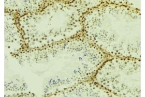 ABIN6277185 at 1/100 staining Mouse testis tissue by IHC-P. (IFIH1 anticorps  (C-Term))