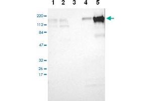 Western blot analysis of Lane 1: RT-4, Lane 2: U-251 MG, Lane 3: A-431, Lane 4: Liver, Lane 5: Tonsil with TJP2 polyclonal antibody at 1:100-1:250 dilution.