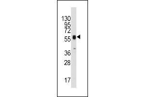 Western blot analysis of anti-ECGF1(Center) Pab (ABIN391460 and ABIN2841435) in HepG2 cell line lysates (35 μg/lane). (Thymidine Phosphorylase anticorps  (AA 318-345))