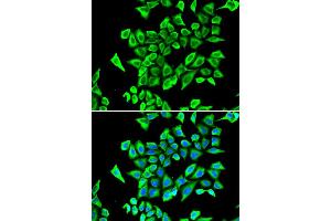Immunofluorescence analysis of A549 cell using LCN2 antibody. (Lipocalin 2 anticorps)